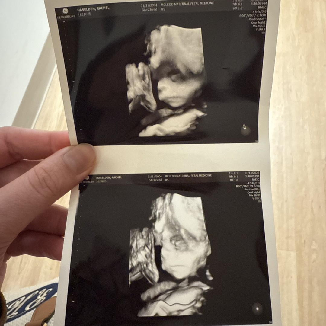 Photo shared by Rachel for their Babylist baby registry.