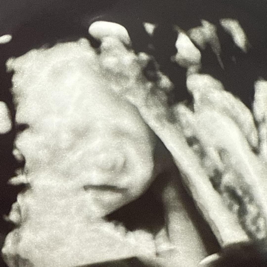 Photo shared by Elise for their Babylist baby registry.