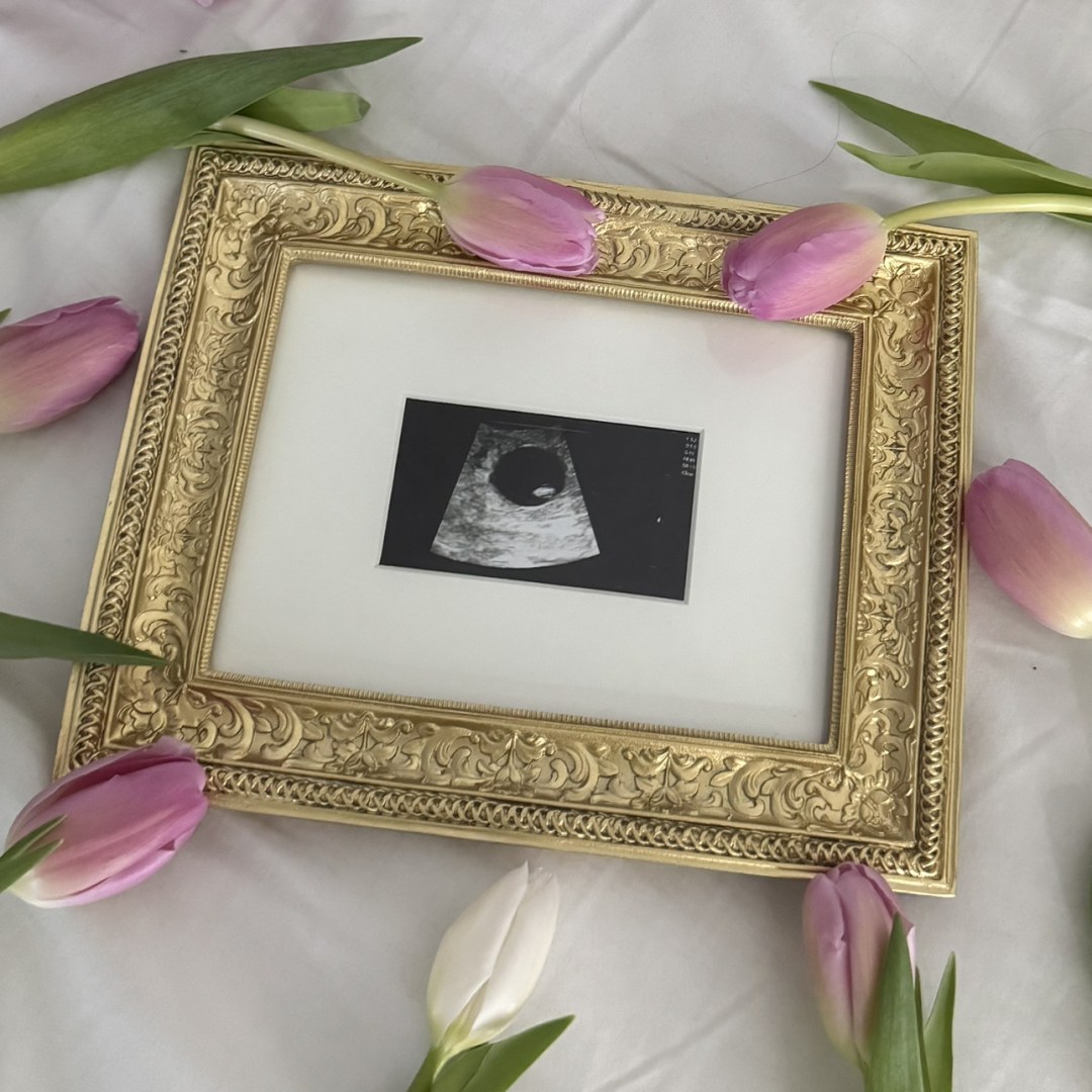 Photo shared by Ruthanne for their Babylist baby registry.