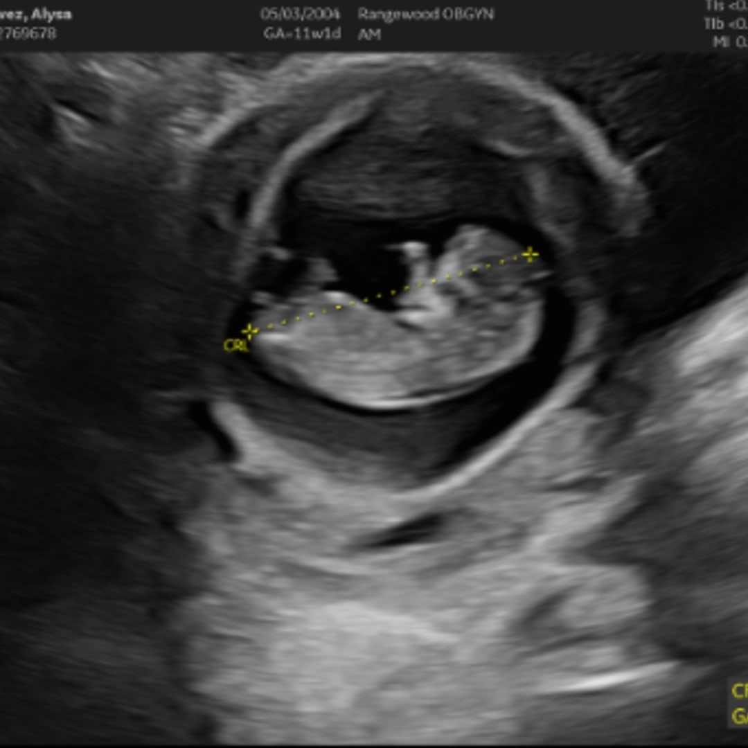 Photo shared by Alysa for their Babylist baby registry.