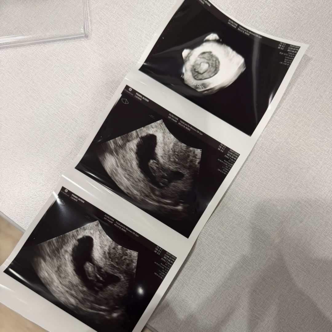 Photo shared by Alyssa for their Babylist baby registry.