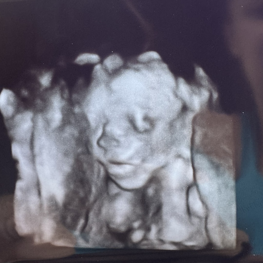 Photo shared by Lexi for their Babylist baby registry.