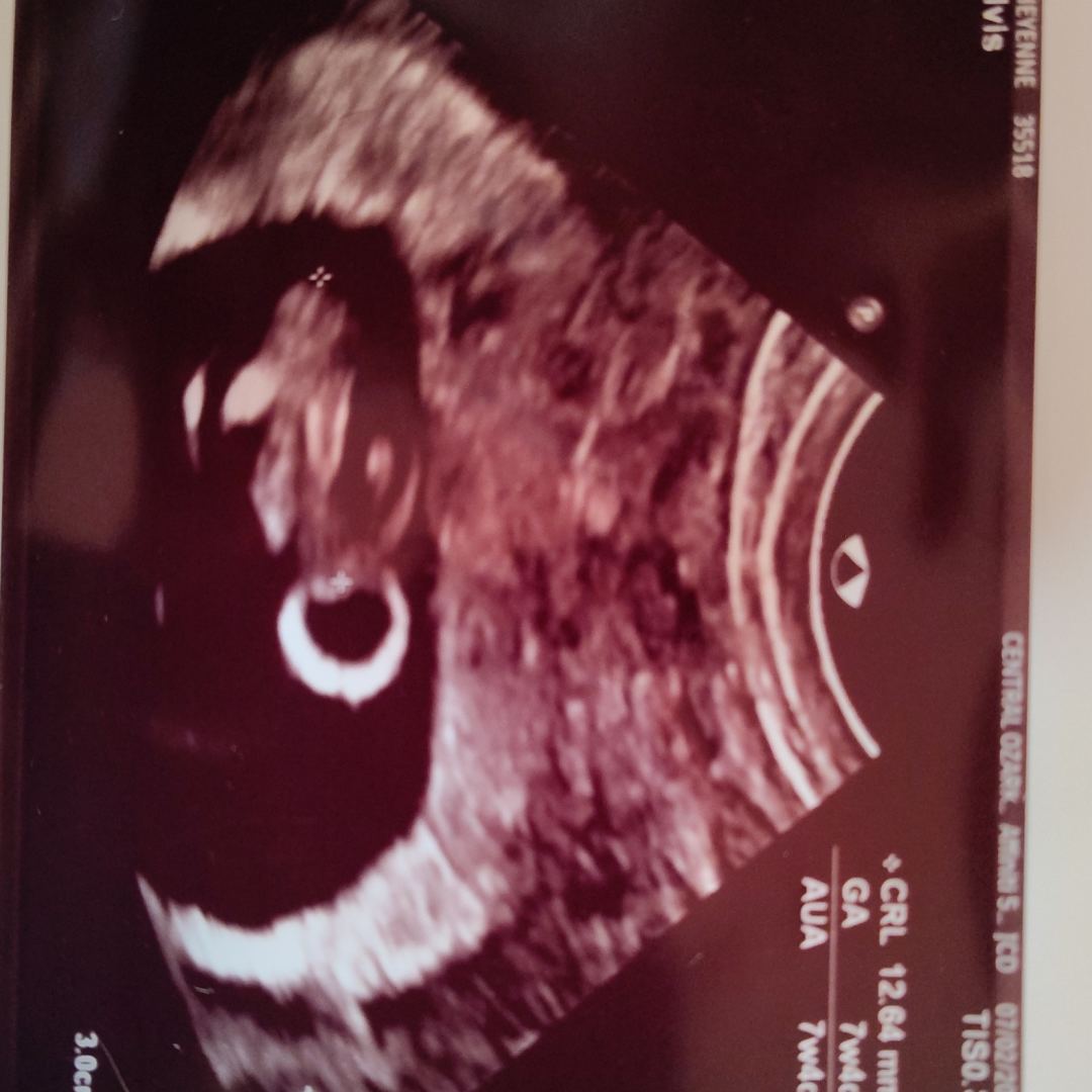 Photo shared by Cheyenne for their Babylist baby registry.