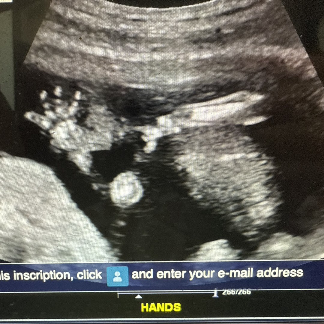 Photo shared by Olga for their Babylist baby registry.