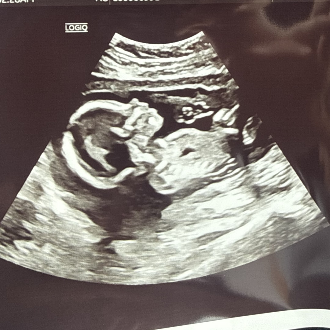 Photo shared by Viviana for their Babylist baby registry.