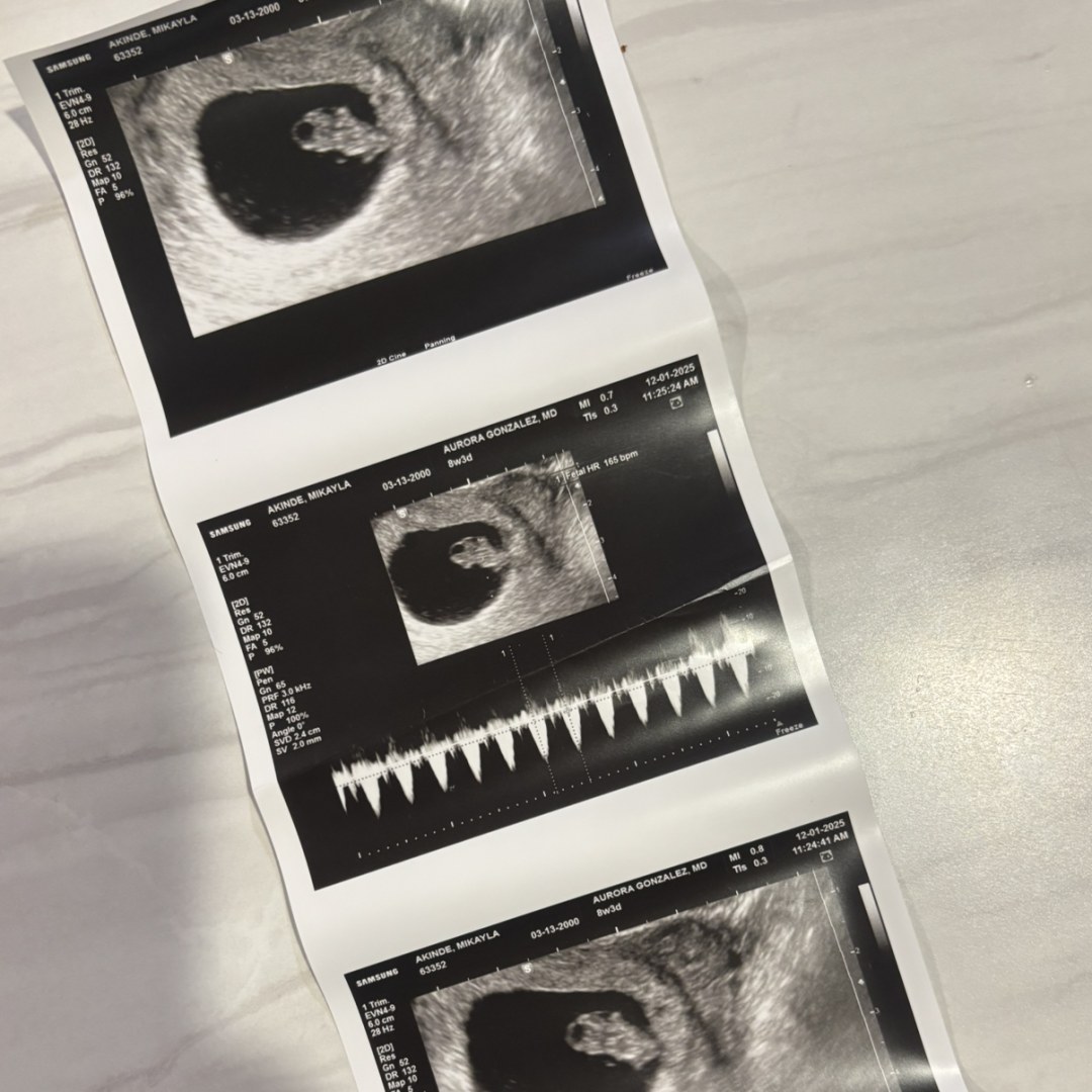 Photo shared by Mikayla for their Babylist baby registry.