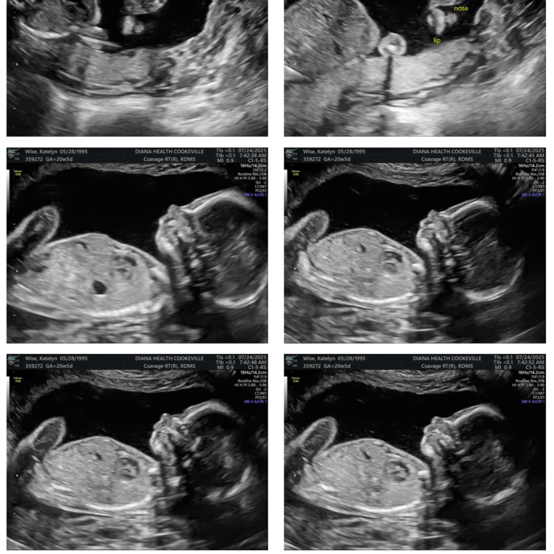 Photo shared by Katelyn for their Babylist baby registry.