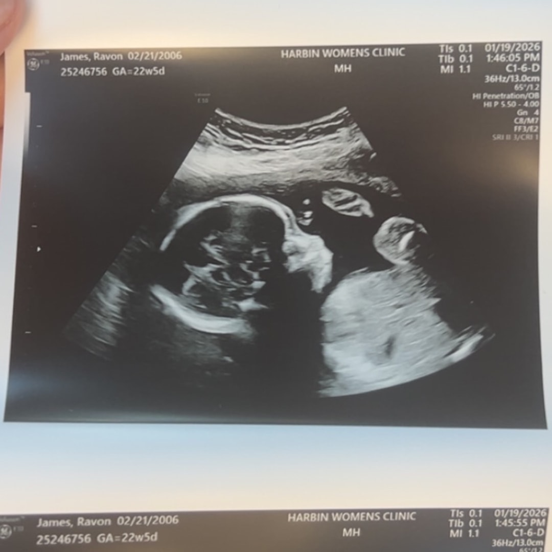 Photo shared by Ravon for their Babylist baby registry.