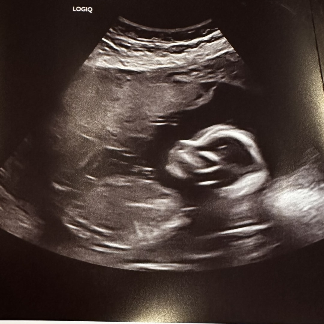 Photo shared by Erica for their Babylist baby registry.