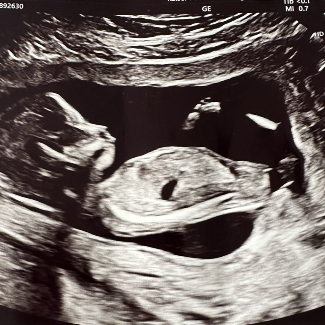 Photo shared by Fei for their Babylist baby registry.