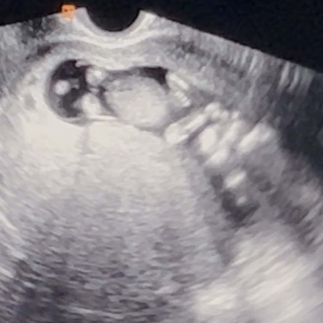 Photo shared by Kaila for their Babylist baby registry.