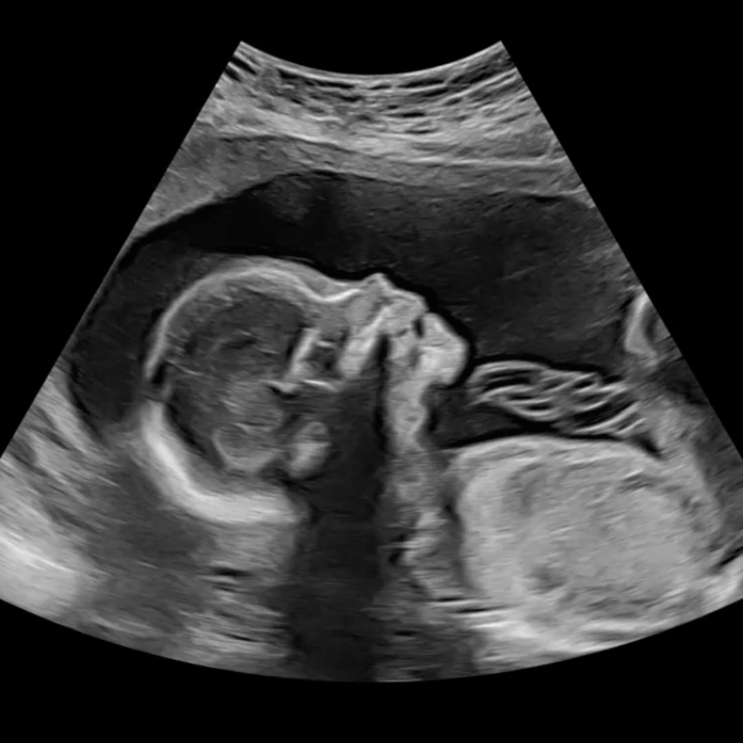 Photo shared by Hannah for their Babylist baby registry.