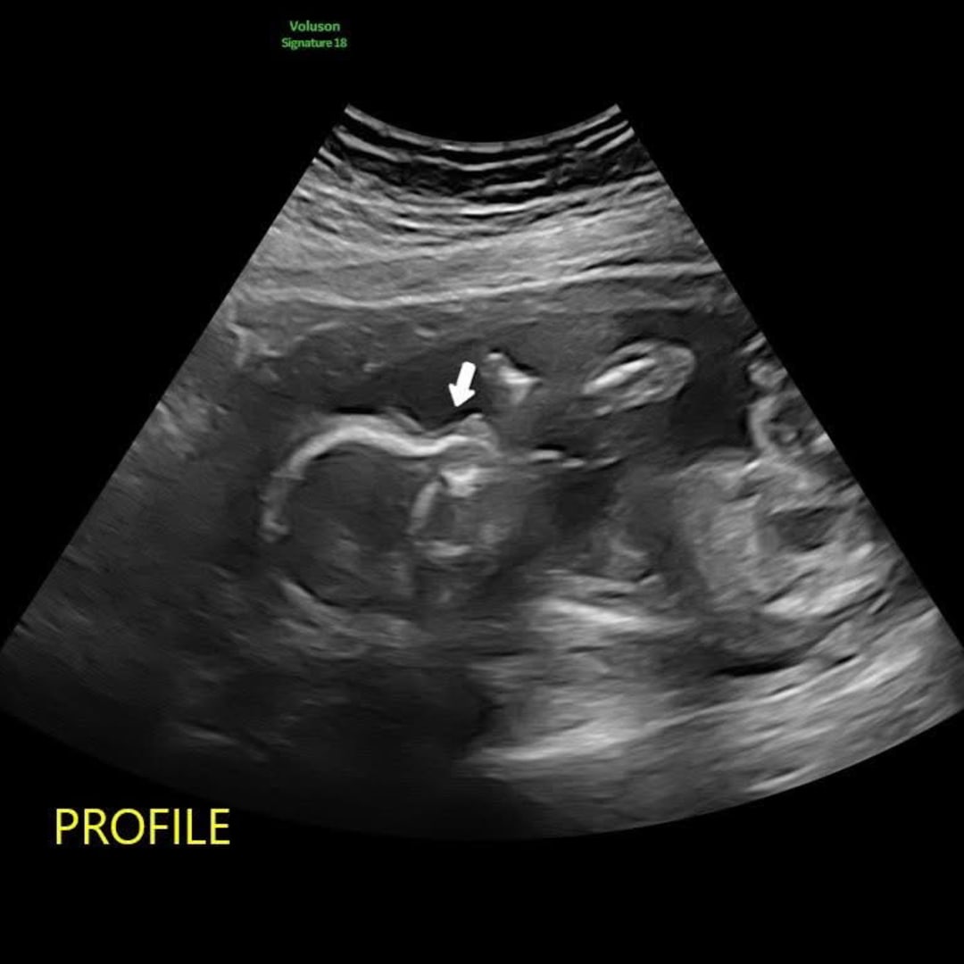 Photo shared by Hannah for their Babylist baby registry.