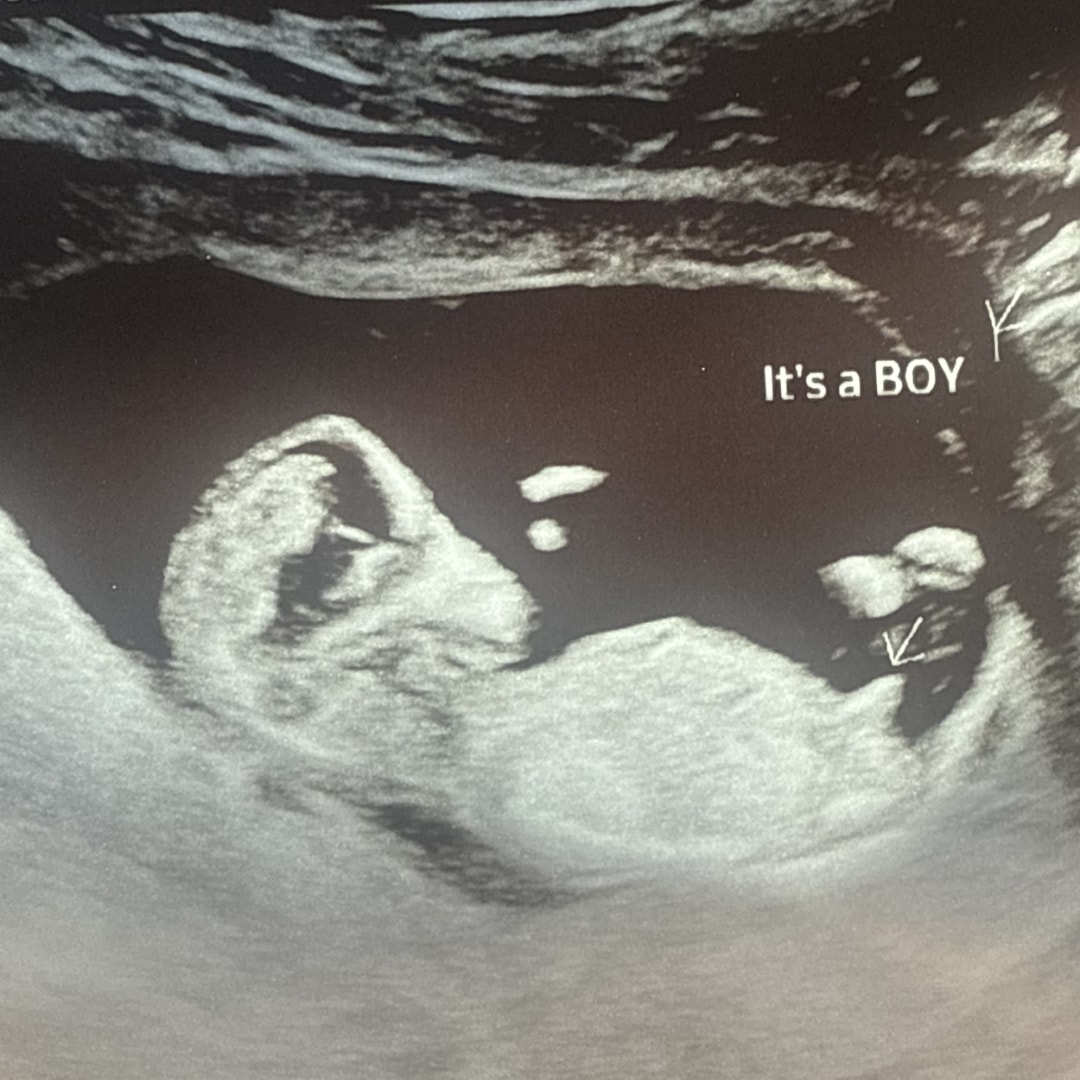 Photo shared by Anna for their Babylist baby registry.