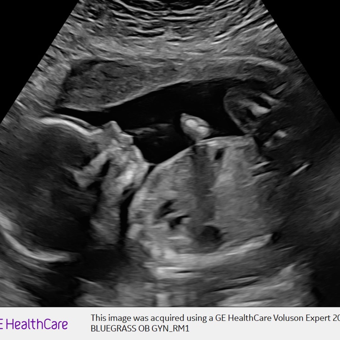 Photo shared by Avery for their Babylist baby registry.
