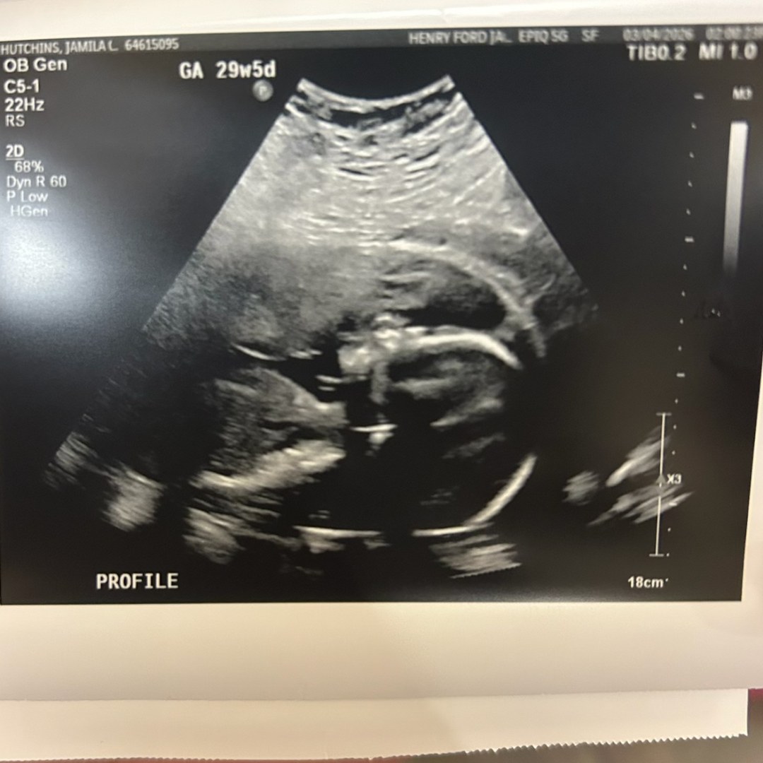 Photo shared by Jamila for their Babylist baby registry.