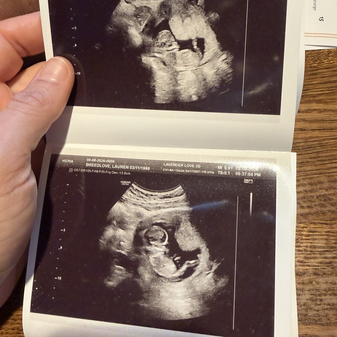 Photo shared by Lauren for their Babylist baby registry.