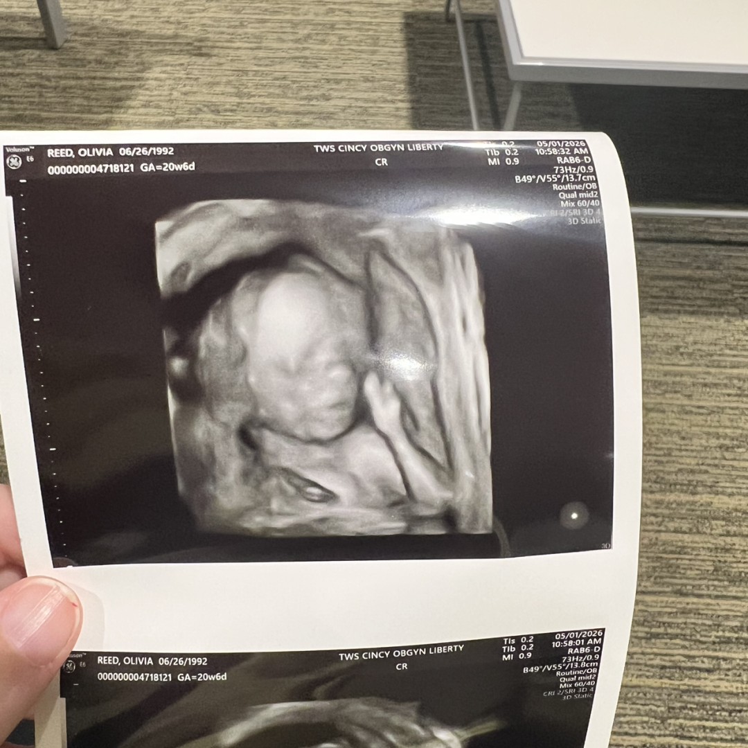 Photo shared by Olivia for their Babylist baby registry.