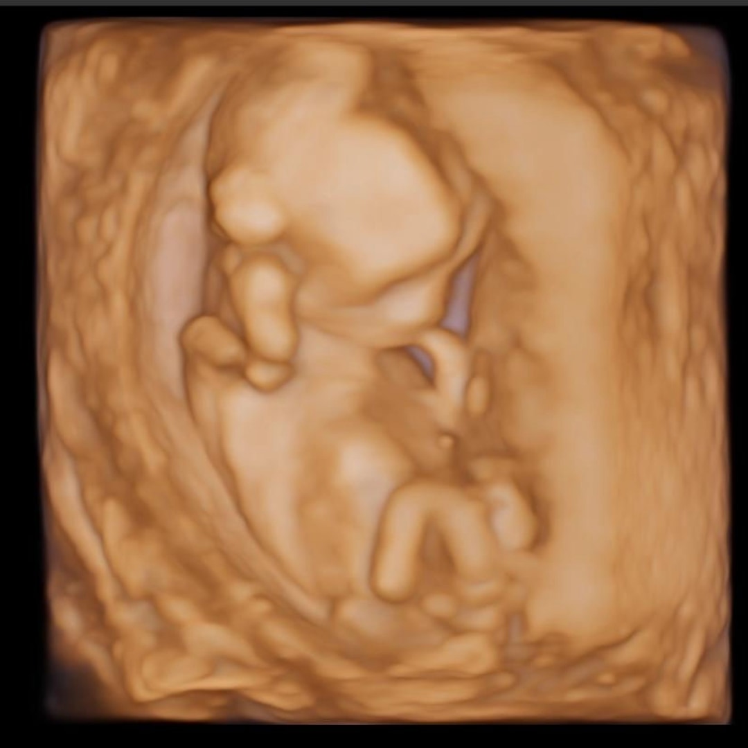 Photo shared by Katelynn for their Babylist baby registry.
