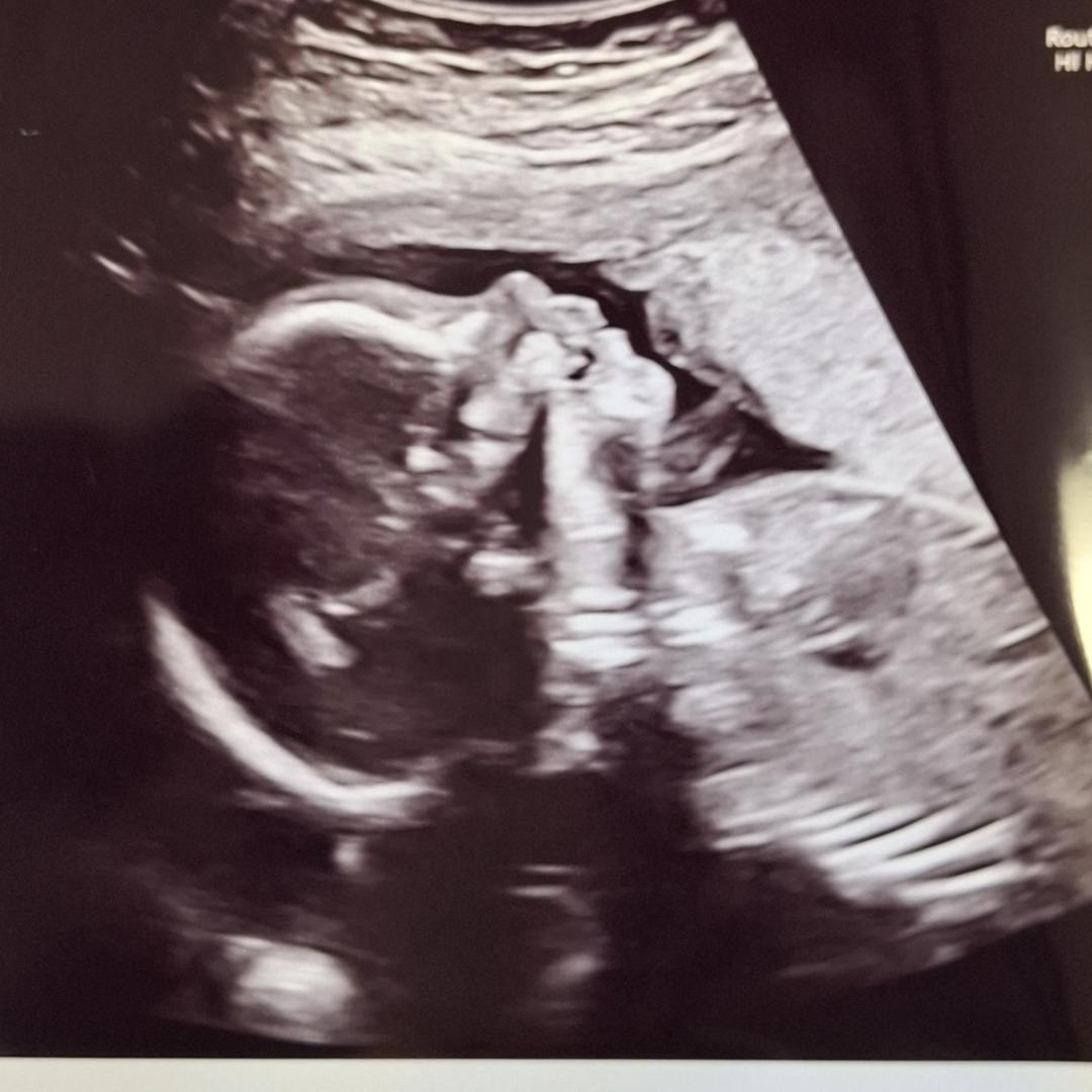 Photo shared by Abby for their Babylist baby registry.