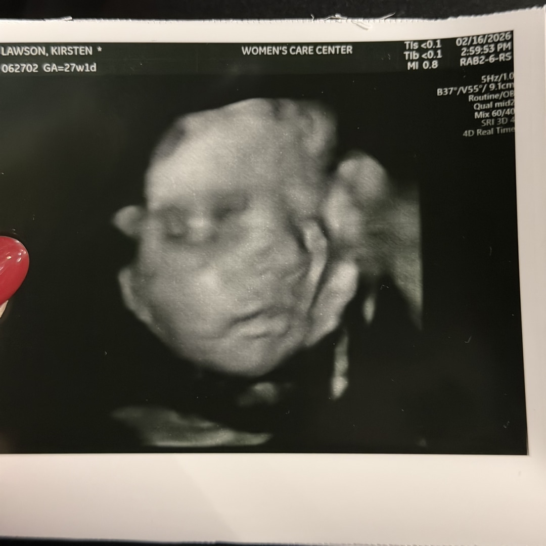 Photo shared by Kirsten for their Babylist baby registry.