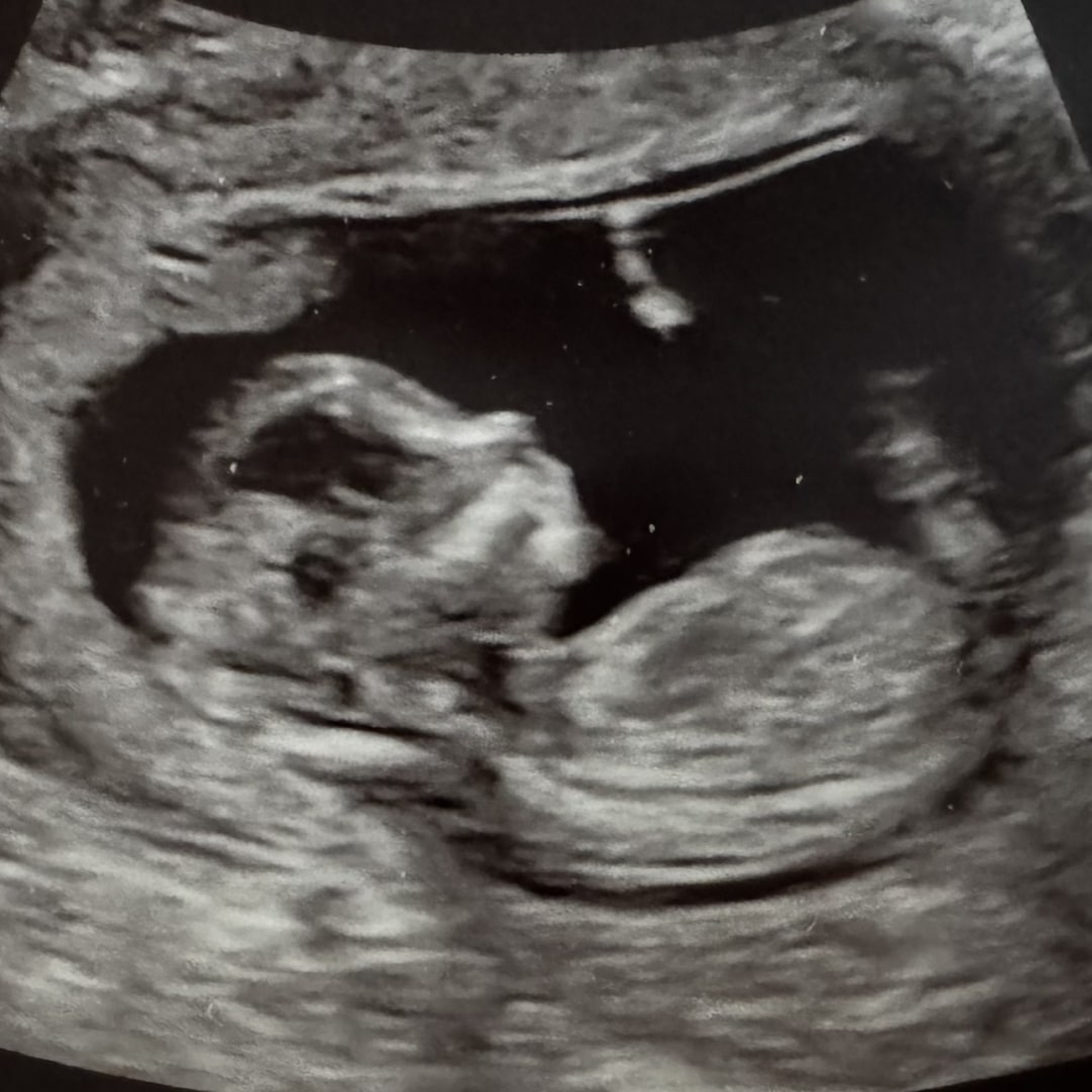 Photo shared by Zoe for their Babylist baby registry.