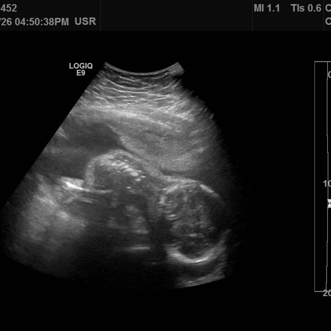 Photo shared by Grace for their Babylist baby registry.