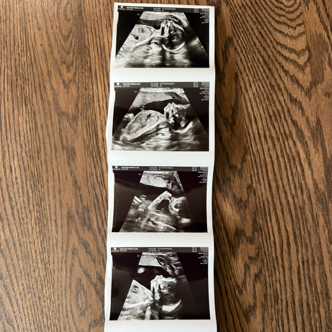 Photo shared by Eliza for their Babylist baby registry.