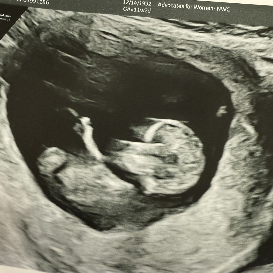 Photo shared by Kaelan for their Babylist baby registry.