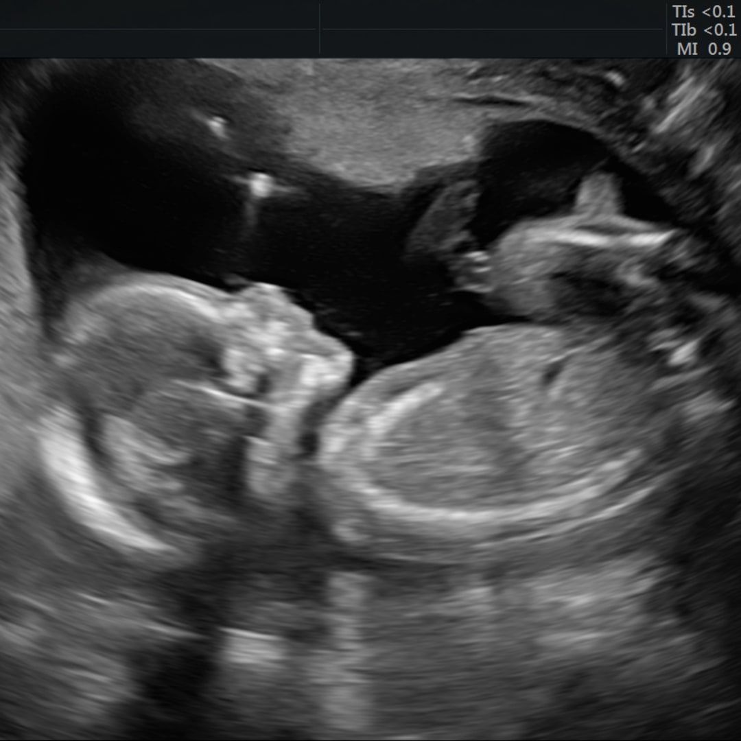 Photo shared by Elizabeth for their Babylist baby registry.