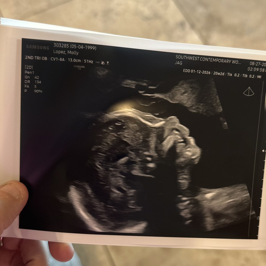 Photo shared by Molly for their Babylist baby registry.
