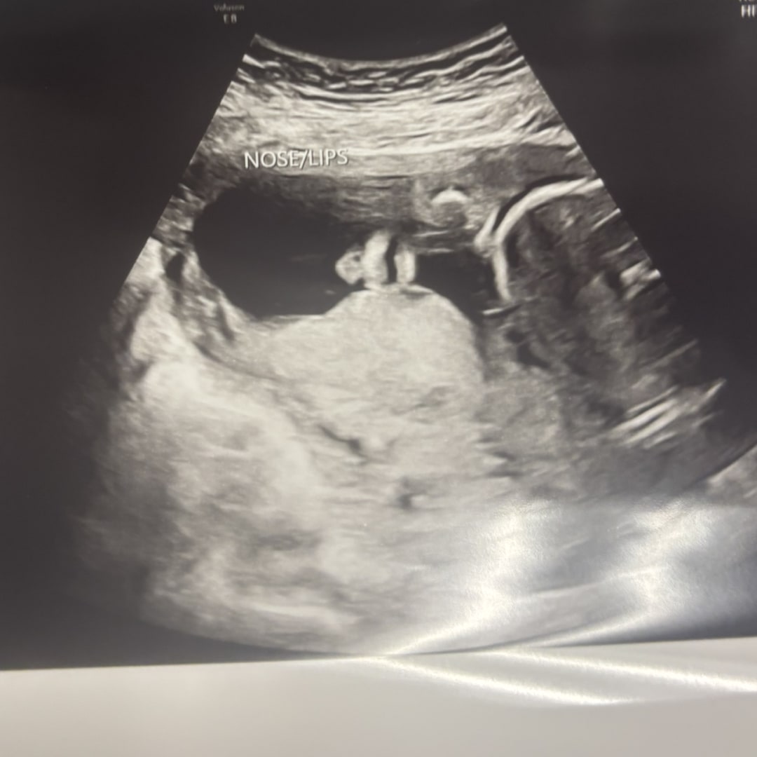 Photo shared by Graycen for their Babylist baby registry.