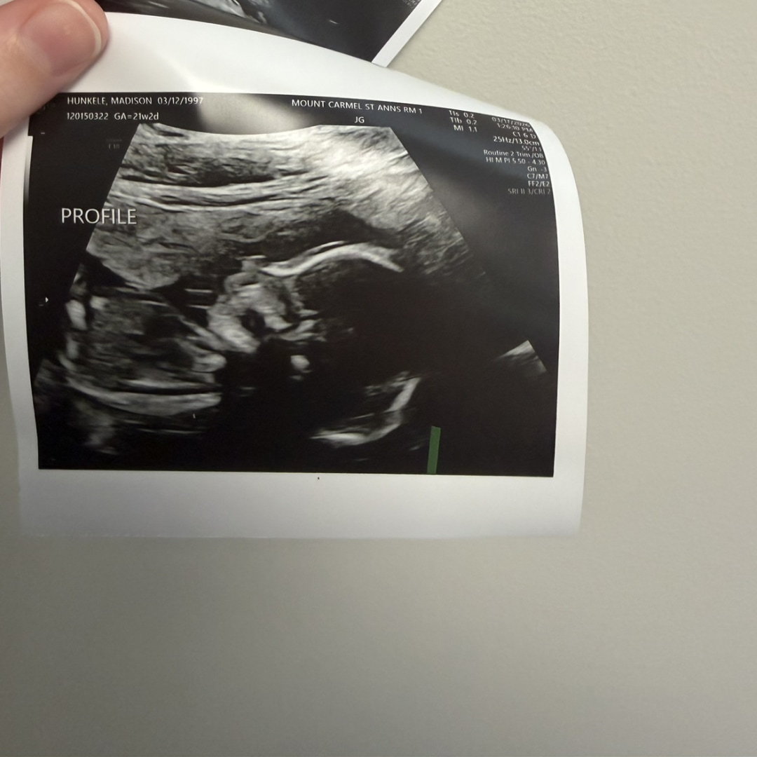Photo shared by Madison for their Babylist baby registry.