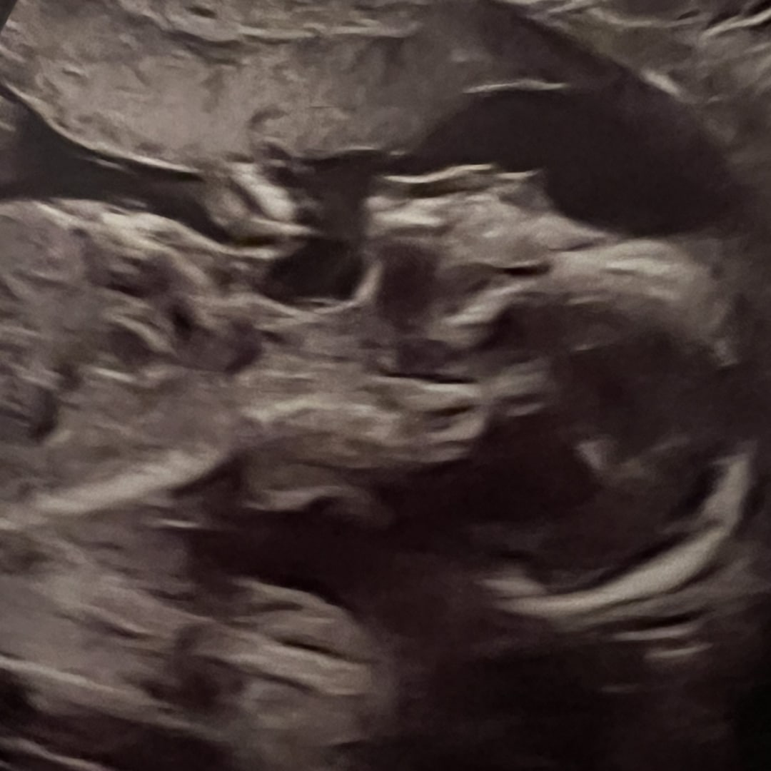Photo shared by Katie for their Babylist baby registry.