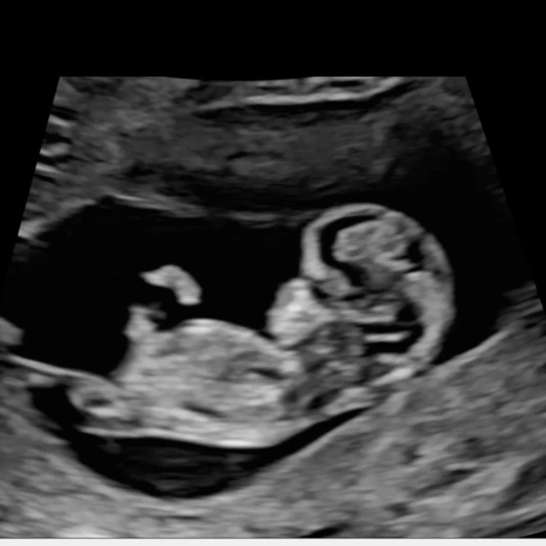Photo shared by Jaylan for their Babylist baby registry.