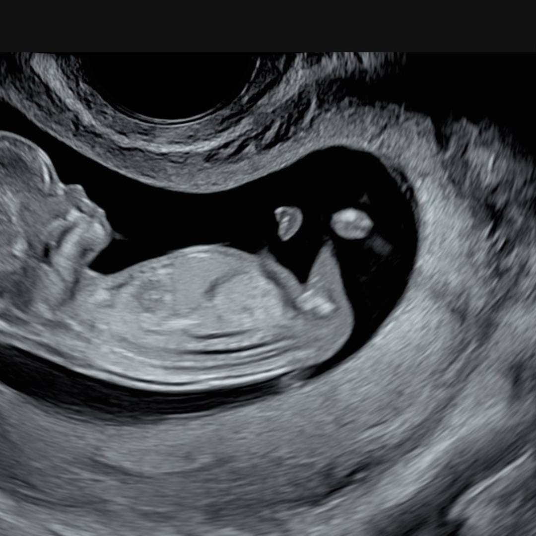 Photo shared by Jessica for their Babylist baby registry.