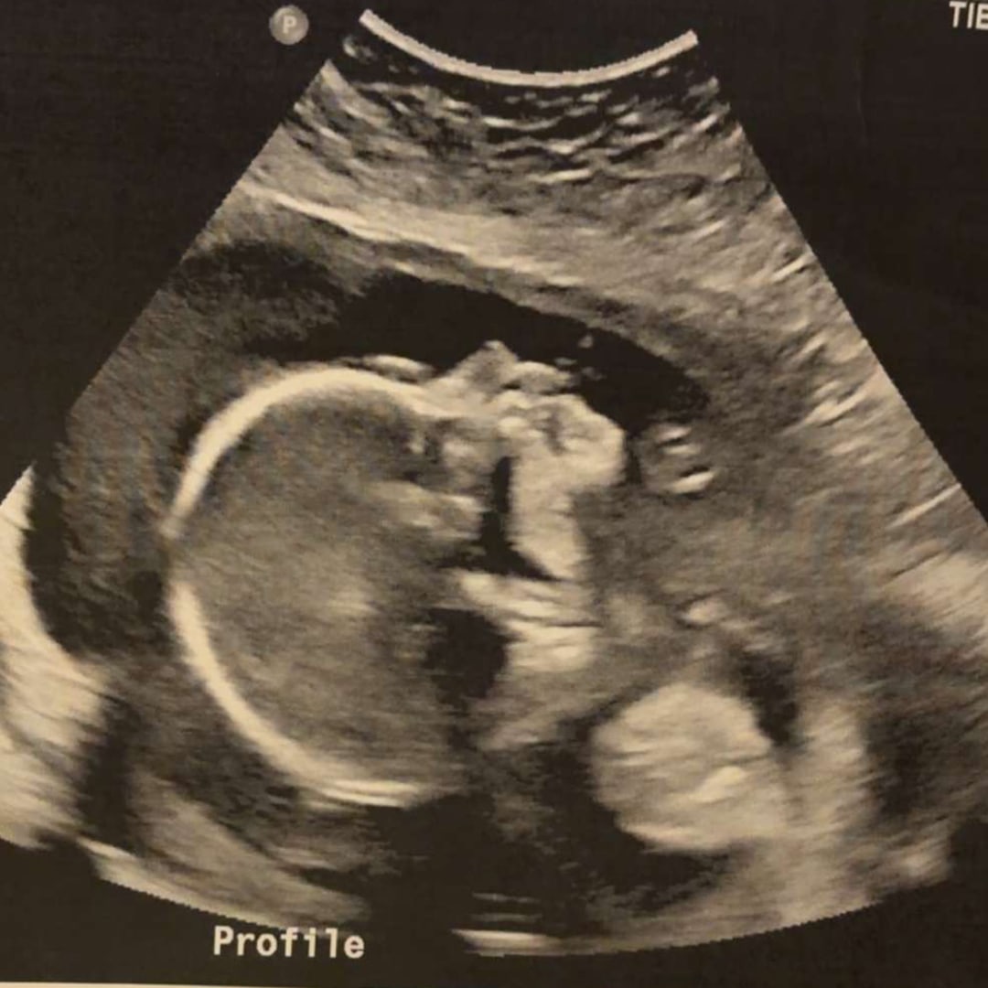 Photo shared by Taylar for their Babylist baby registry.