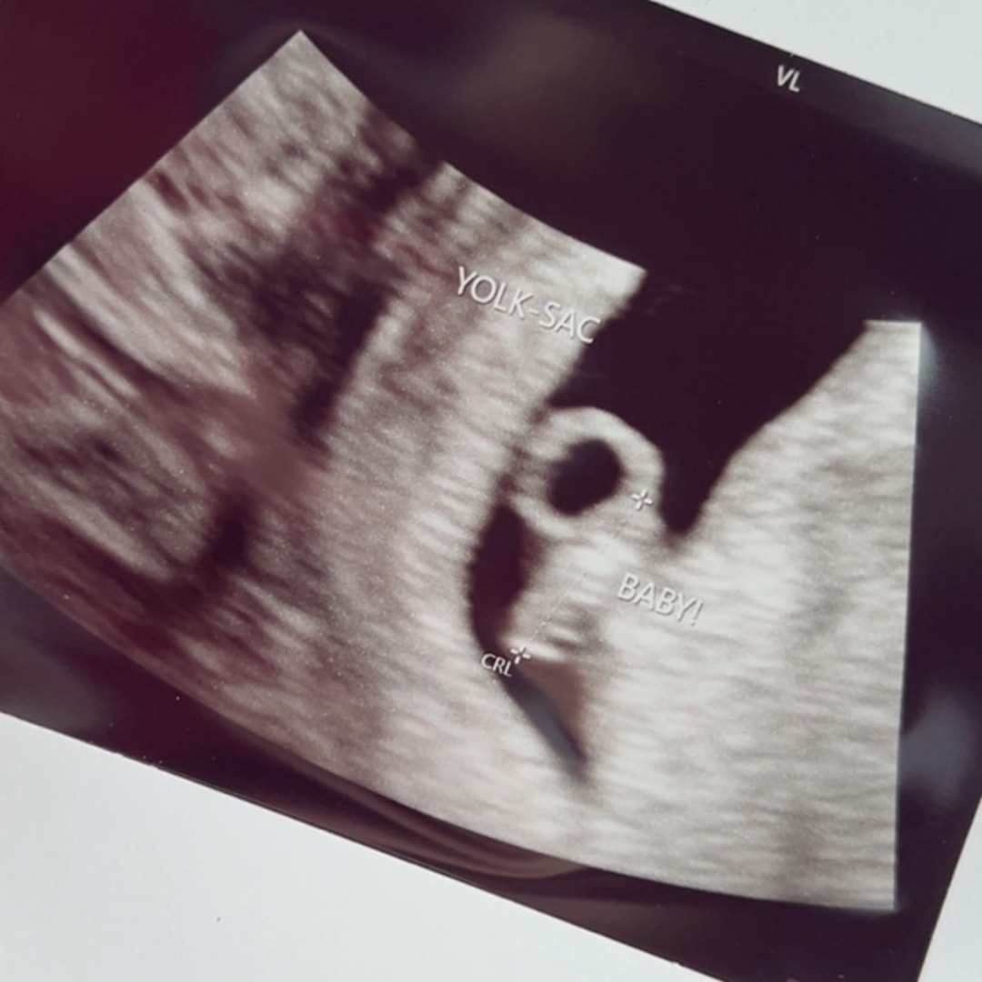 Photo shared by Abbigail for their Babylist baby registry.