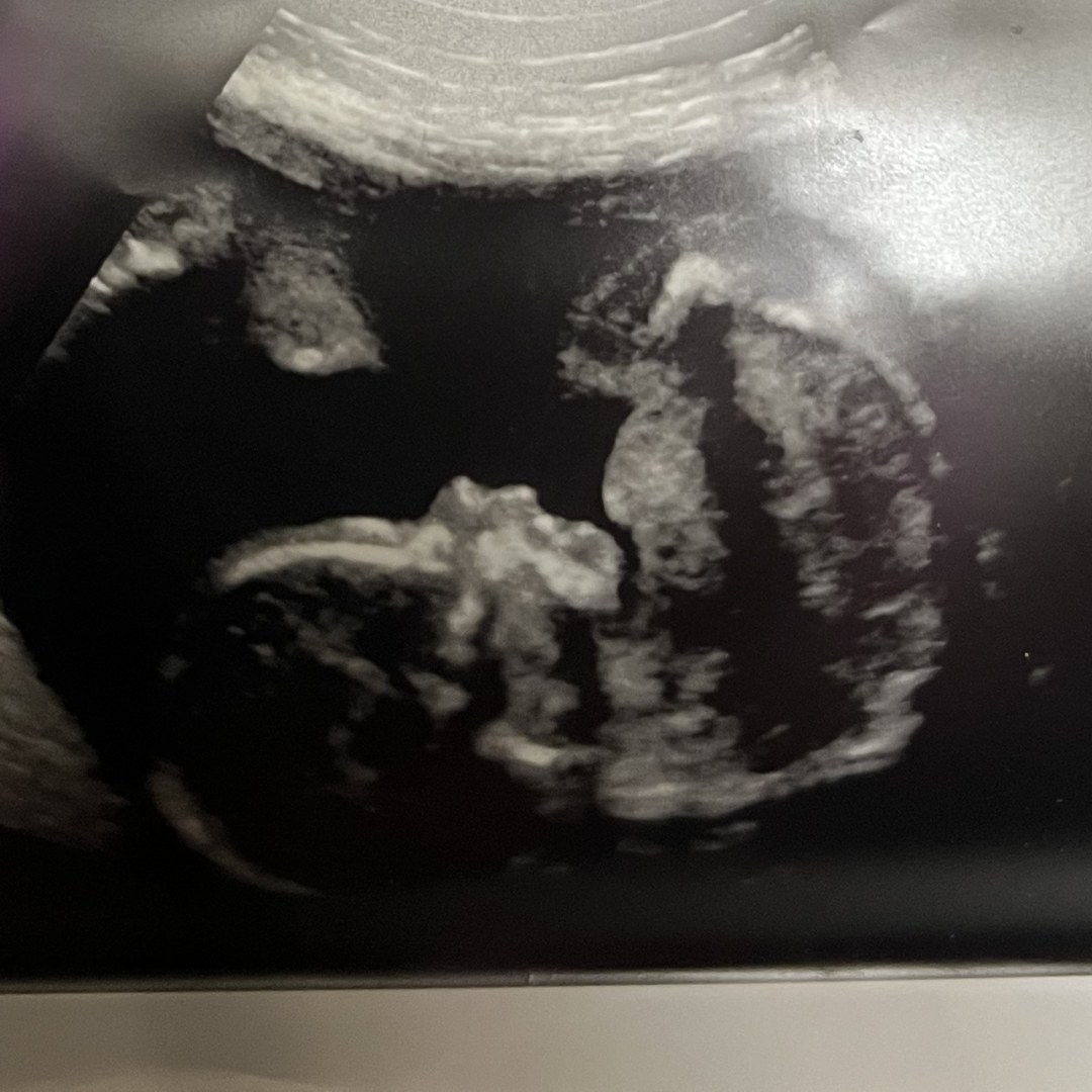 Photo shared by Jessie for their Babylist baby registry.