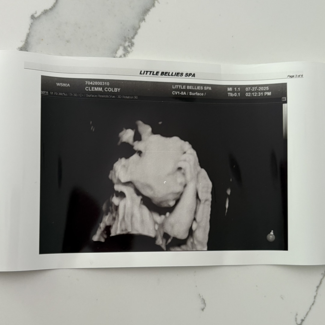 Photo shared by Colby for their Babylist baby registry.