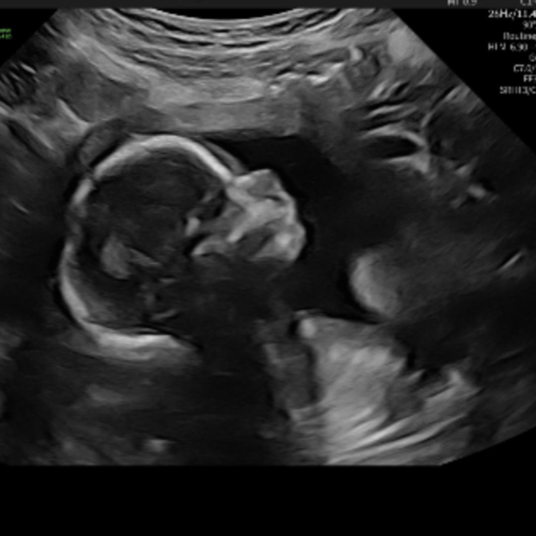 Photo shared by Alyssa for their Babylist baby registry.