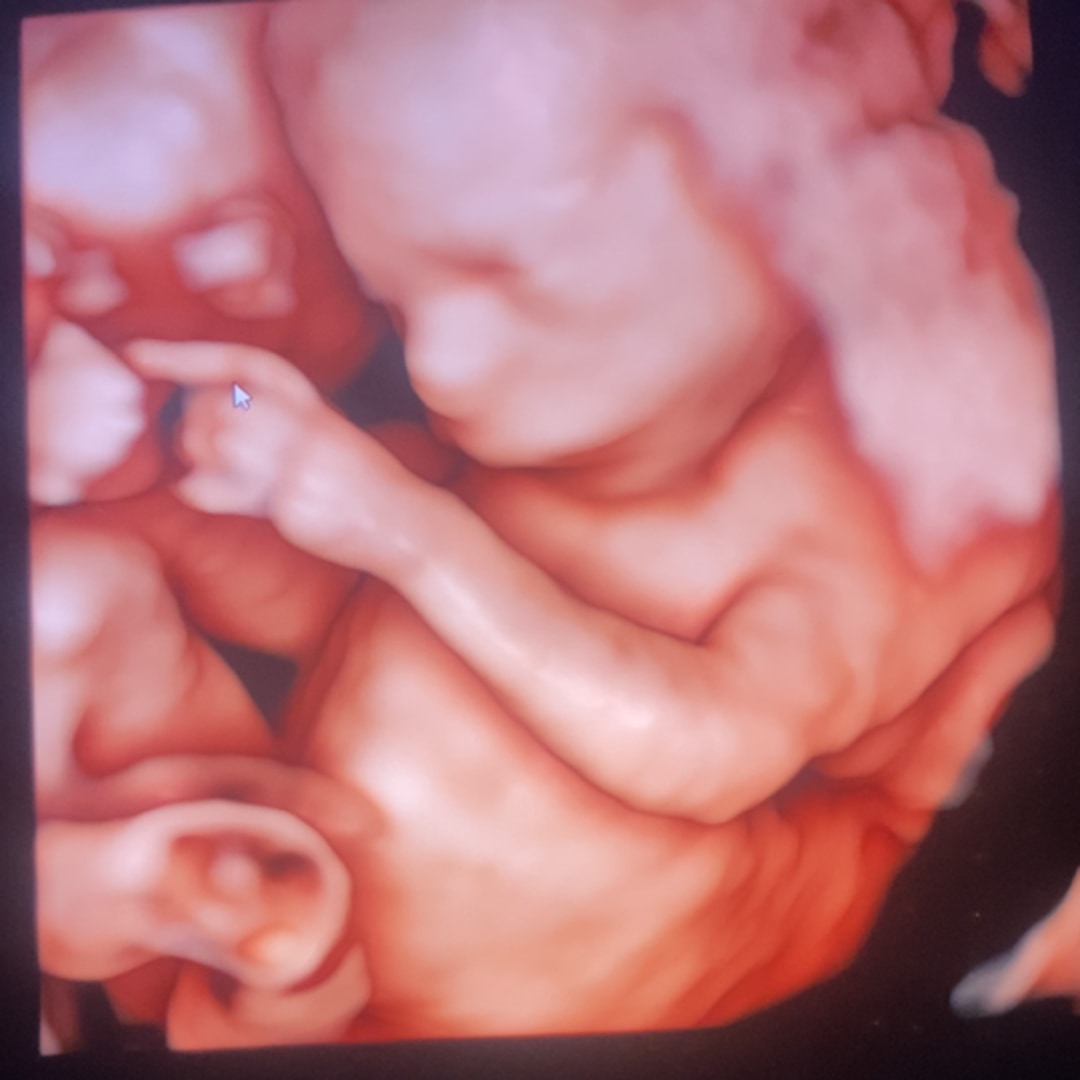 Photo shared by Jasmin for their Babylist baby registry.