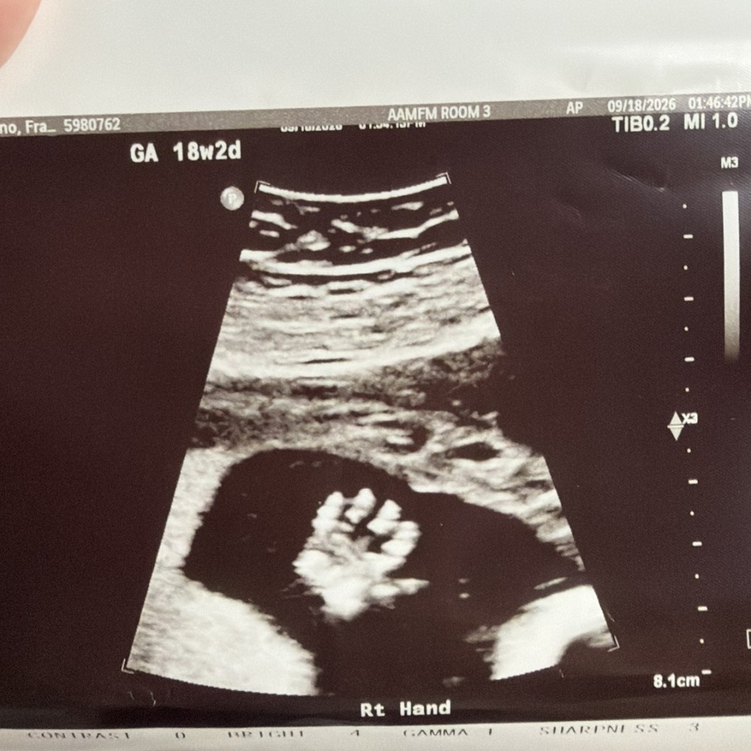 Photo shared by Alexandra for their Babylist baby registry.