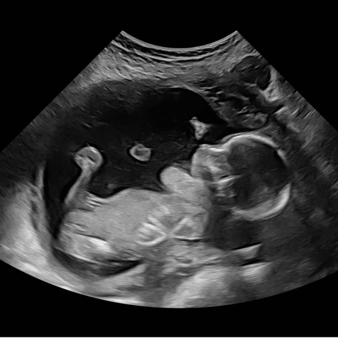 Photo shared by Caroline for their Babylist baby registry.