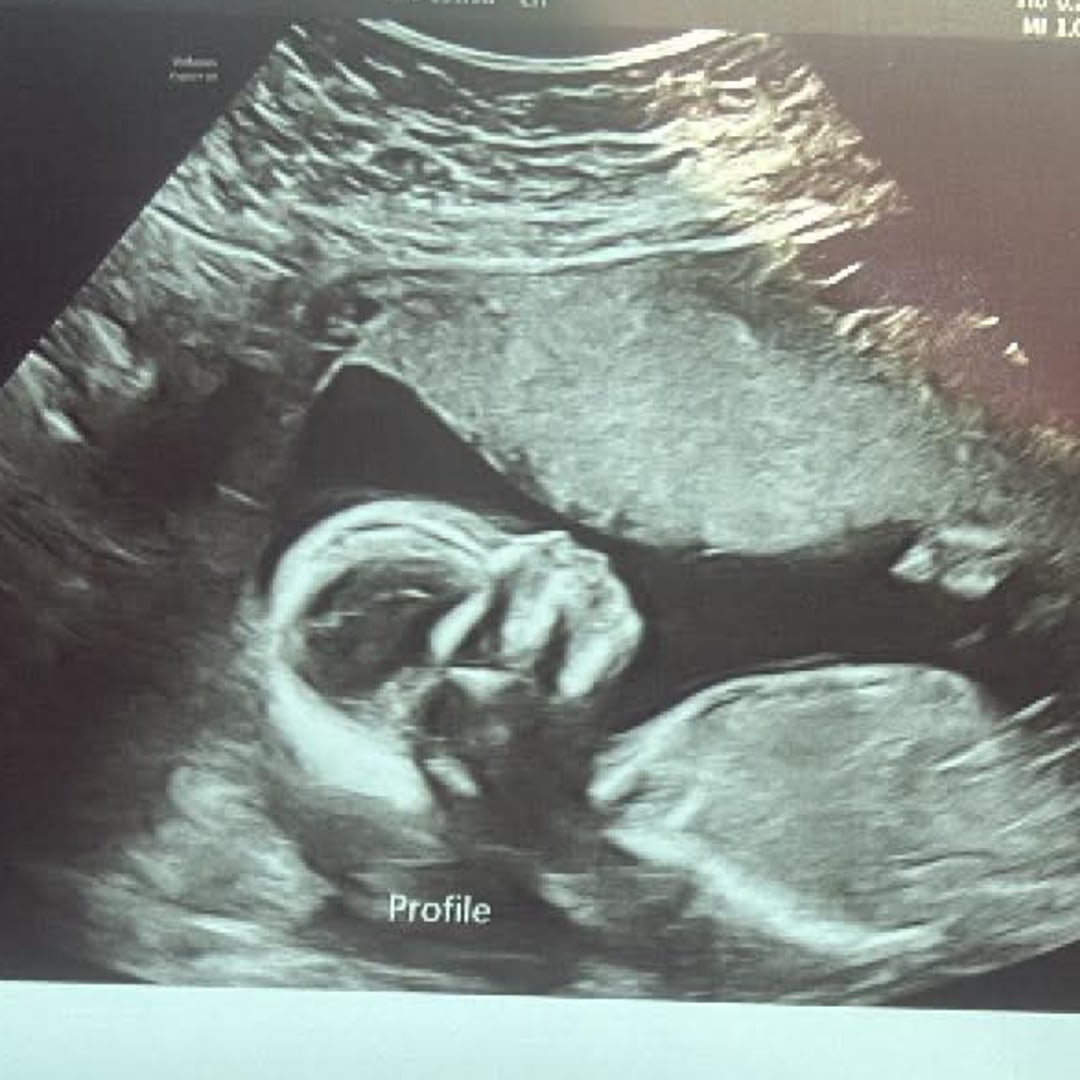 Photo shared by Alexis for their Babylist baby registry.