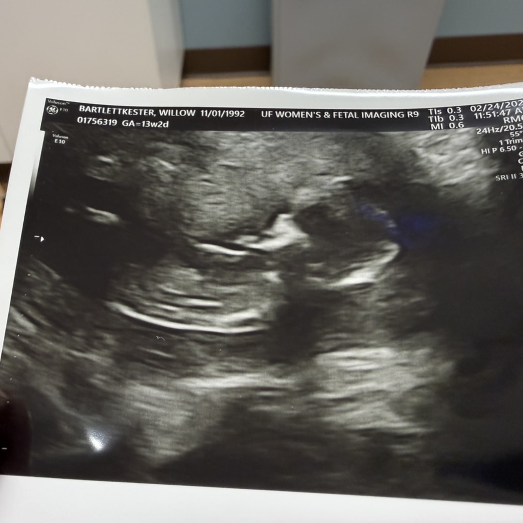 Photo shared by Willow for their Babylist baby registry.