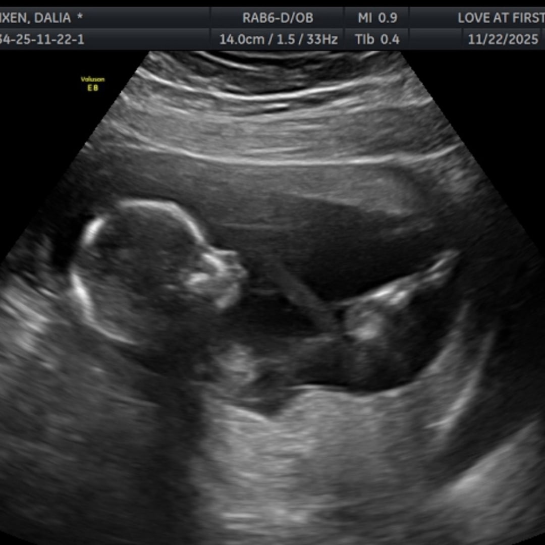 Photo shared by Dalia for their Babylist baby registry.