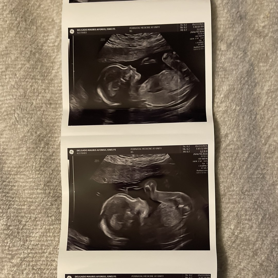 Photo shared by Isnelys for their Babylist baby registry.