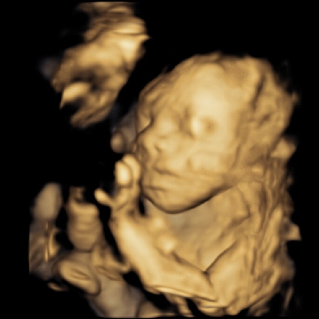 Photo shared by Harriet for their Babylist baby registry.