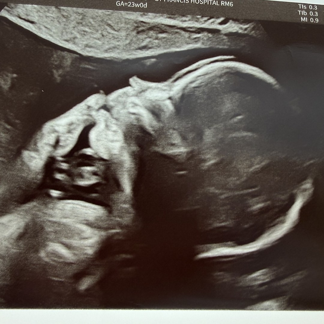 Photo shared by Carina for their Babylist baby registry.